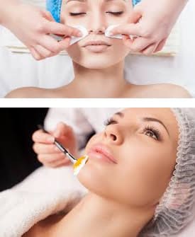 Chemical Peel Treatments, Facial Peel Treatment and Facial Chemical Peels