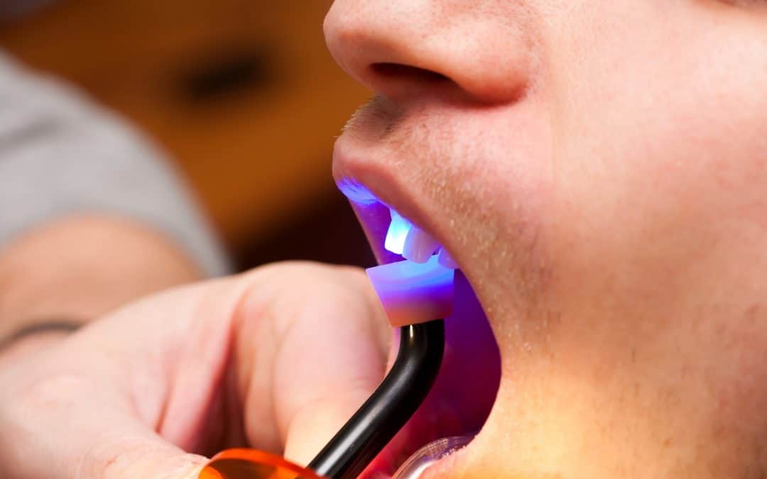 Dentist working with dental light