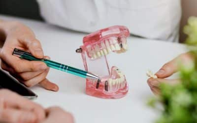 Types of Dental Implants: Which Option is Right for You?