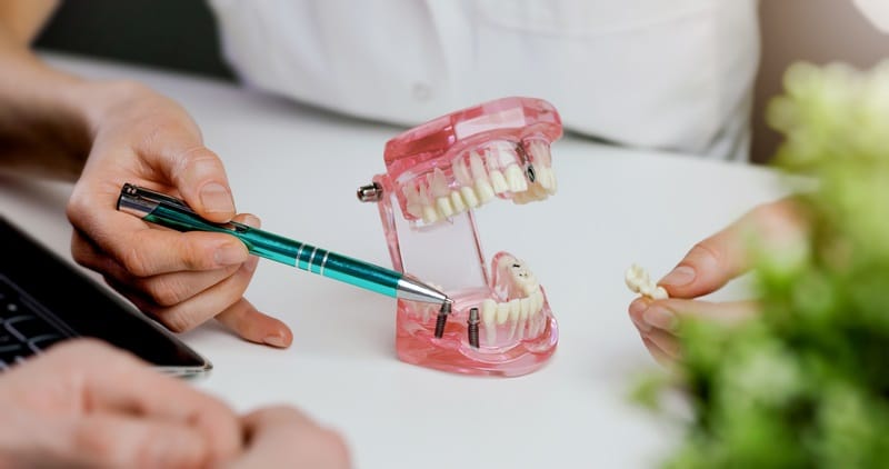 dentist showing dental implant technology