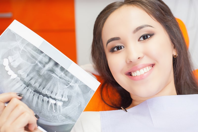 Should You Consider a Dental Implant Procedure?