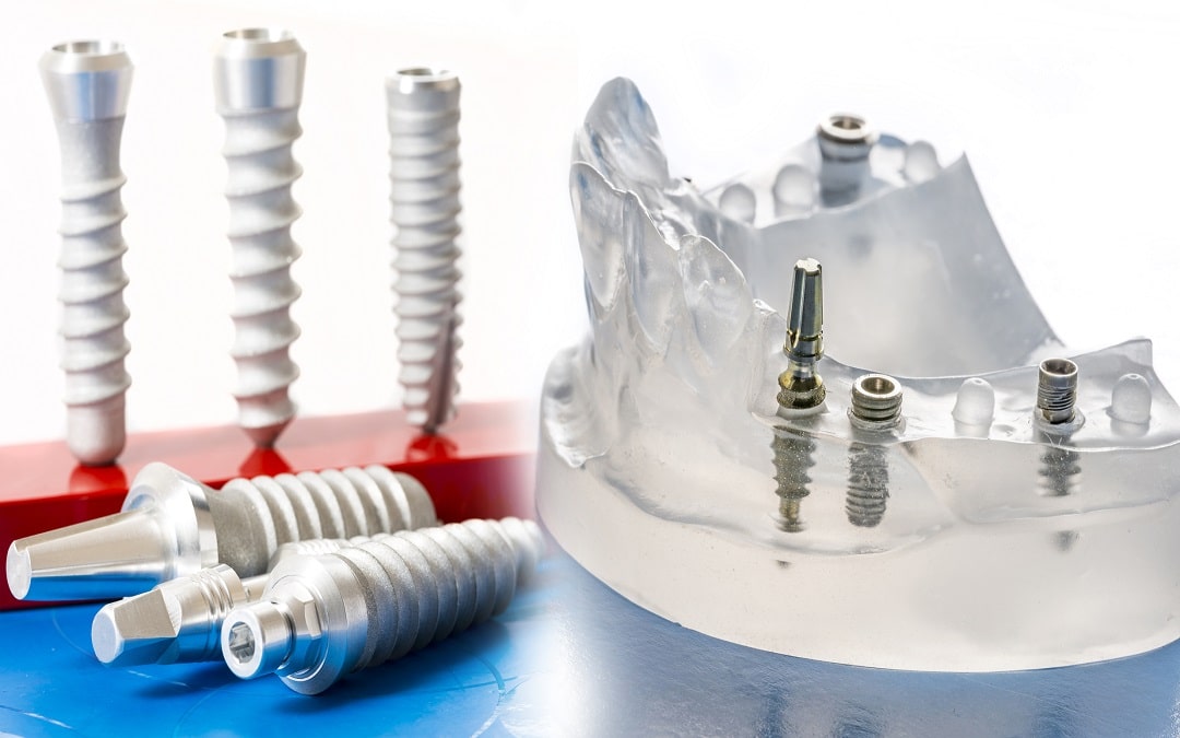 Dental implants recovery time