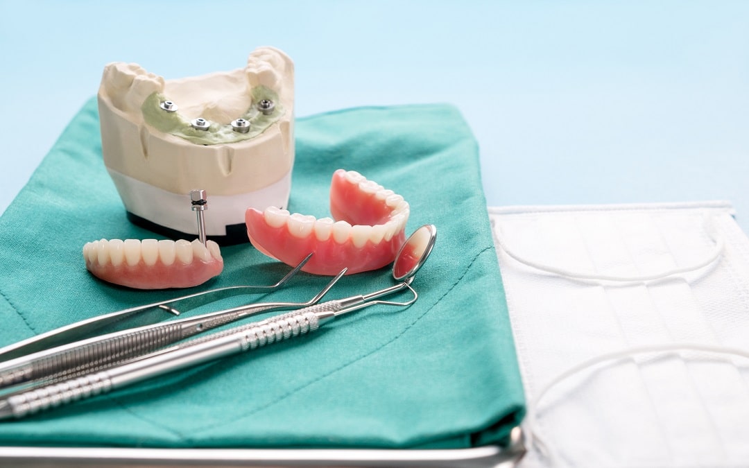 How Much Does Dental Implants Cost in the UK